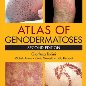 Atlas of Genodermatoses 2nd by Gianluca Tadini