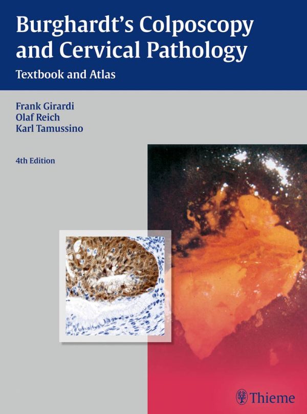 Burghardt's Colposcopy and Cervical Pathology_ Textbook and Atlas 4th by Frank Gir
