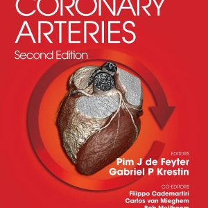 Computed Tomography of the Coronary Arteries 2nd Edition by Pim J. de Feyter
