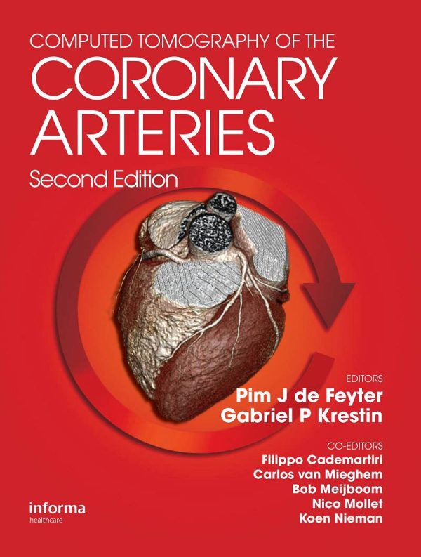 Computed Tomography of the Coronary Arteries 2nd Edition by Pim J. de Feyter