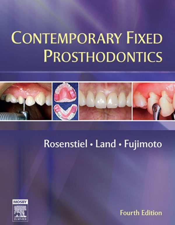 Contemporary Fixed Prosthodontics 4th Edition by Stephen F. Rosenstiel