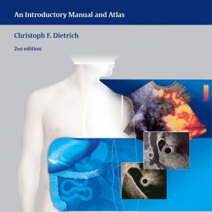 Endoscopic Ultrasound An Introductory Manual and Atlas 2nd Edition by Christoph Frank Dietrich
