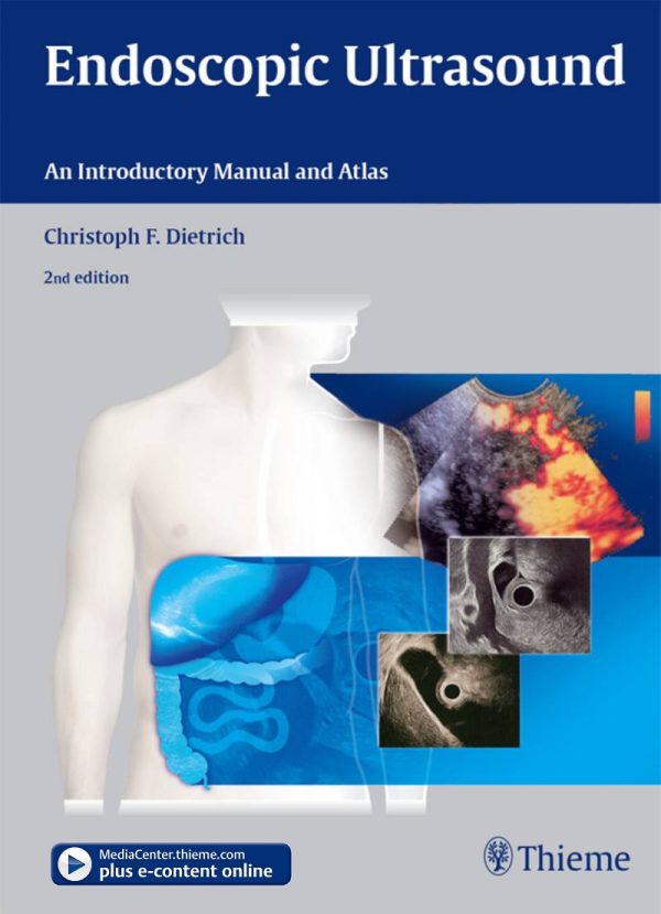 Endoscopic Ultrasound An Introductory Manual and Atlas 2nd Edition by Christoph Frank Dietrich