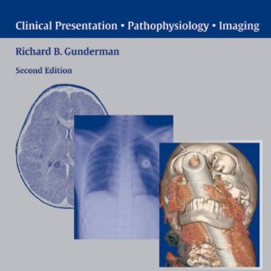 Essential Radiology Clinical Presentation Pathophysiology Imaging 2nd Edition by Richard B. Gunderman