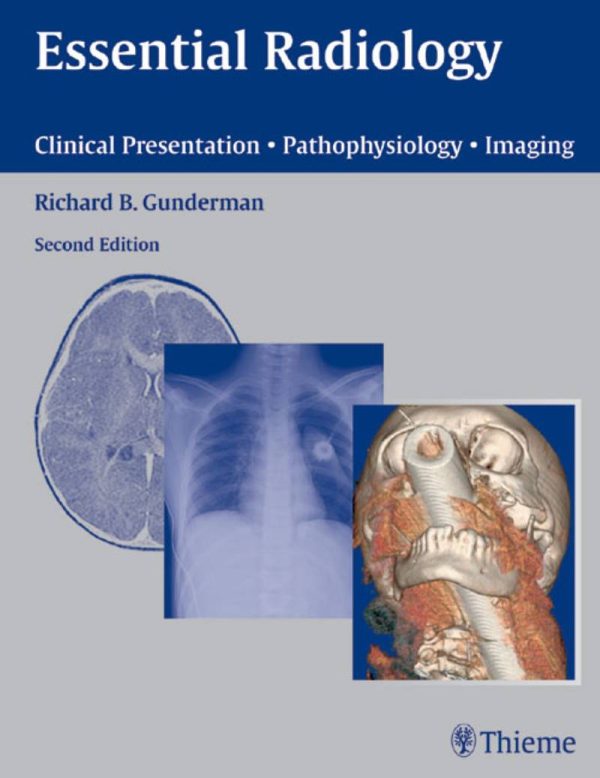 Essential Radiology Clinical Presentation Pathophysiology Imaging 2nd Edition by Richard B. Gunderman