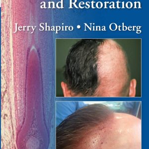 Hair Loss and Restoration 2nd Edition by Jerry Shapiro