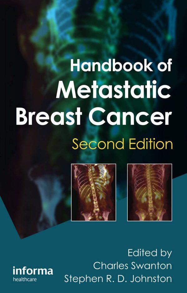 Handbook of Metastatic Breast Cancer 2nd Edition by Charles Swanton