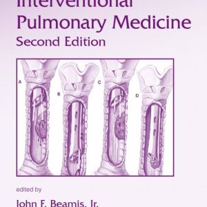 Interventional Pulmonary Medicine 2nd Edition by John F. Beamis
