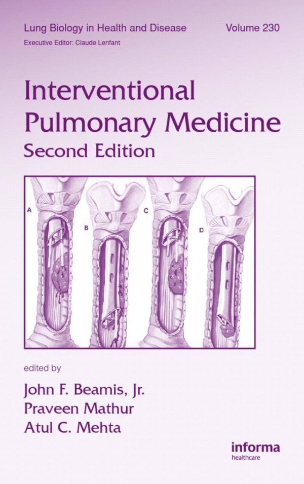 Interventional Pulmonary Medicine 2nd Edition by John F. Beamis