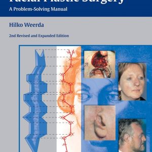 Reconstructive Facial Plastic Surgery A Problem-Solving Manual 2nd Edition by Hilko Weerda