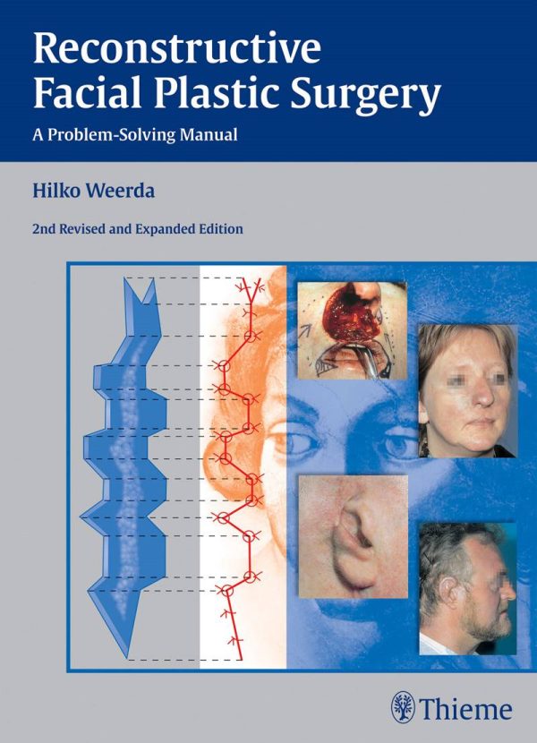 Reconstructive Facial Plastic Surgery A Problem-Solving Manual 2nd Edition by Hilko Weerda