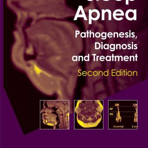 Sleep Apnea Pathogenesis Diagnosis and Treatment 2nd Edition by Allan I. Pack