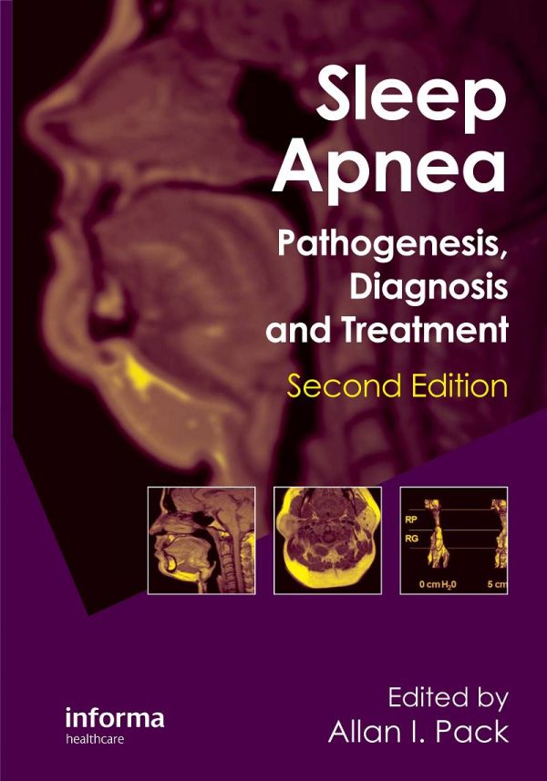 Sleep Apnea Pathogenesis Diagnosis and Treatment 2nd Edition by Allan I. Pack